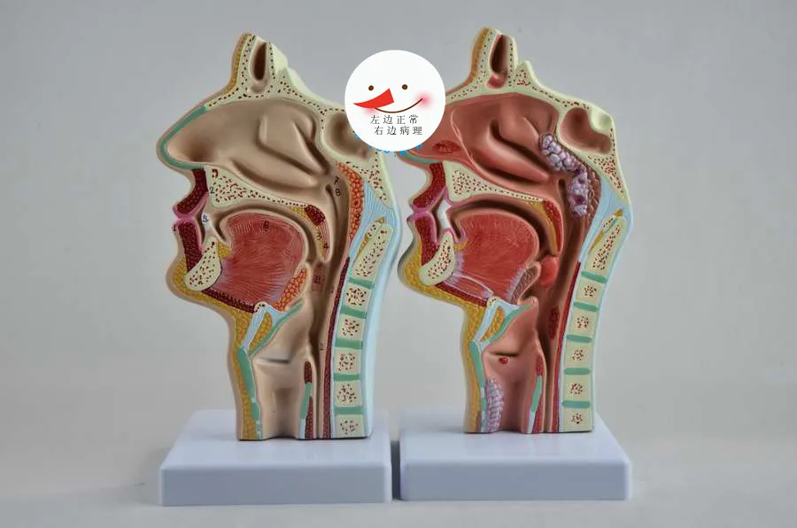 cavității nazale și a gâtului Anatomic model rupt gâtul patologie ORL model Imagine 1